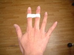 突き指 側副靱帯を保護するためのテーピング